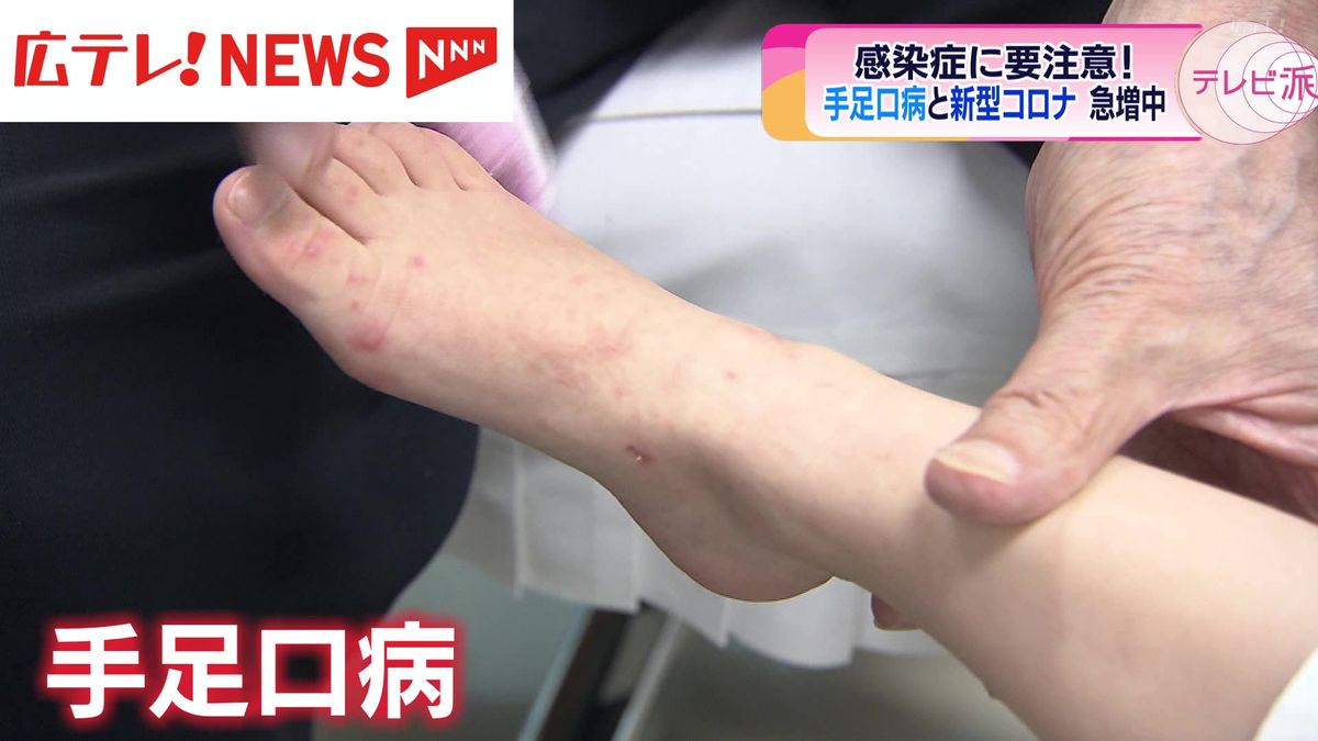 「手足口病」「新型コロナウイルス」感染症に注意！