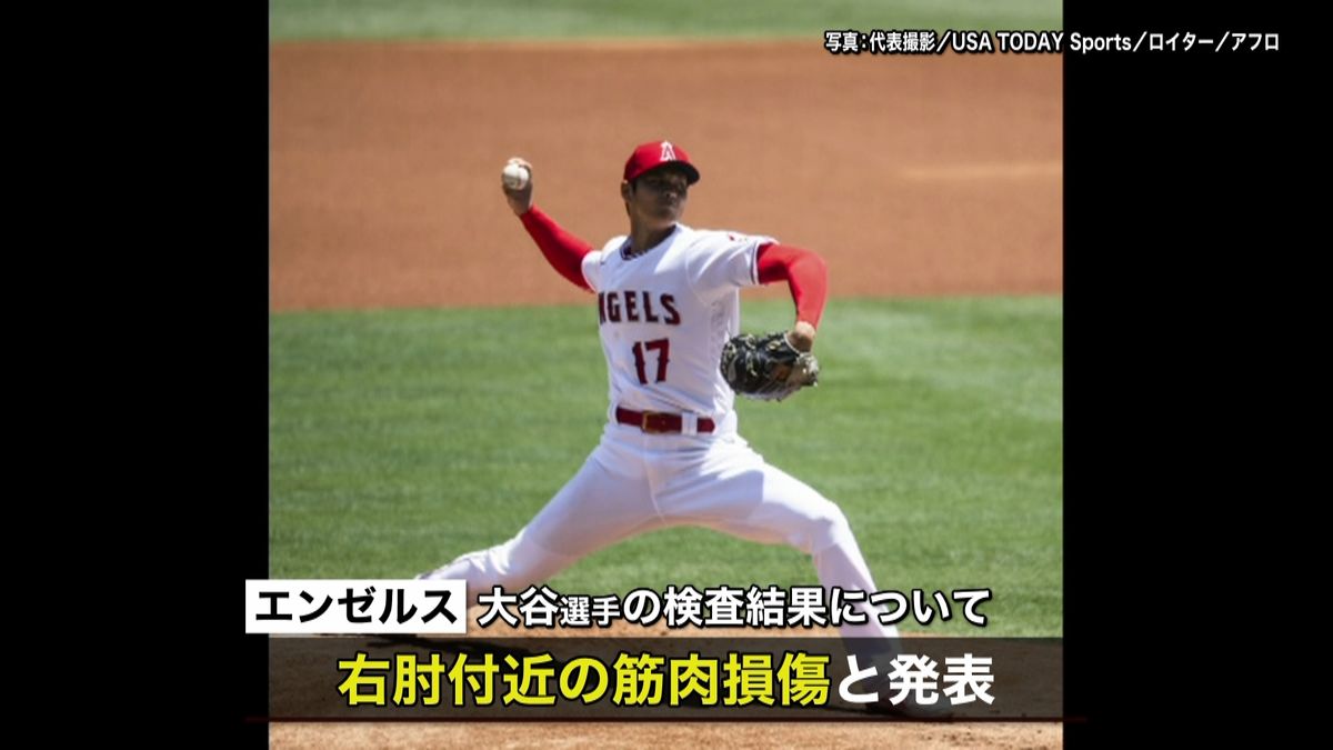 大谷、右肘付近の筋肉損傷　今季登板厳しく