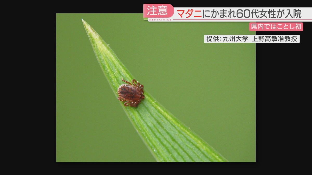 福岡県でことし初めてマダニの被害　60代女性が入院　草むらなどに多く生息・春から秋に活動が活発化　対策やかまれた時の注意点は？
