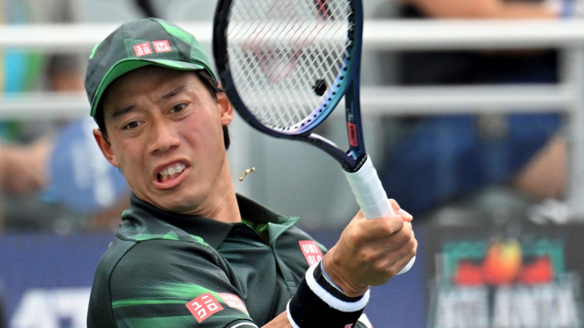 錦織圭選手、撮影7月(写真：AP/アフロ)